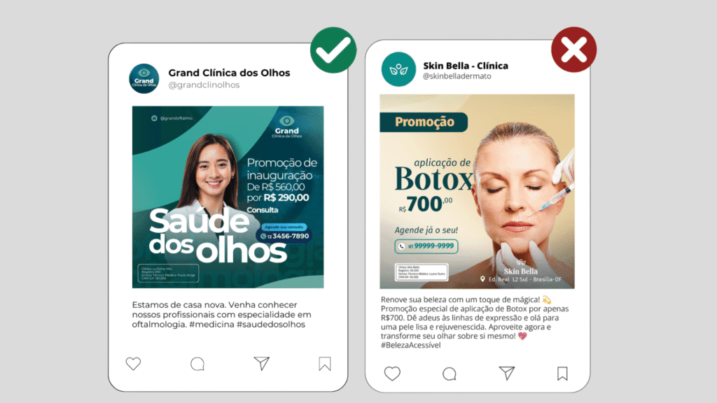 Exemplo comparativo de postagens no Instagram relacionadas ao marketing para médicos. À esquerda, campanha permitida sobre saúde dos olhos com valores de consulta. À direita, erro comum: promoção de Botox com linguagem apelativa e promessa de resultado, contrariando as normas do CFM.